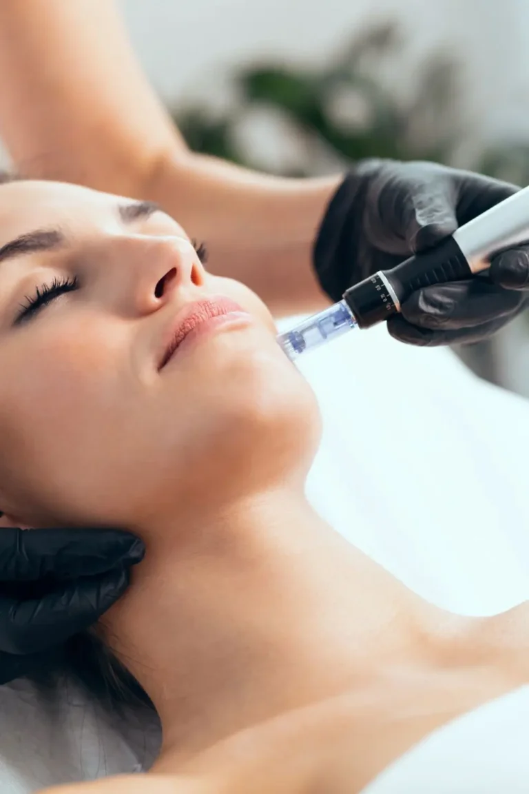 Mezoterapia mikroigłowa w klinice DermaElite w Lesznie